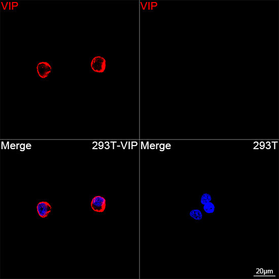 VIP Antibody in Immunocytochemistry (ICC/IF)