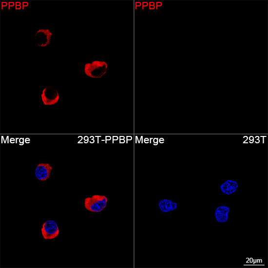 PPBP Antibody in Immunocytochemistry (ICC/IF)