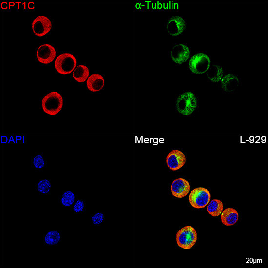 CPT1C Antibody in Immunocytochemistry (ICC/IF)