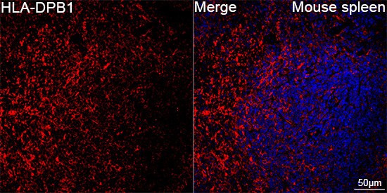 HLA-DPB1 Antibody in Immunohistochemistry (Paraffin) (IHC (P))
