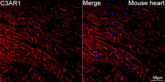 C3a Receptor Antibody in Immunohistochemistry (Paraffin) (IHC (P))