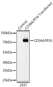 PI16 Antibody in Western Blot (WB)