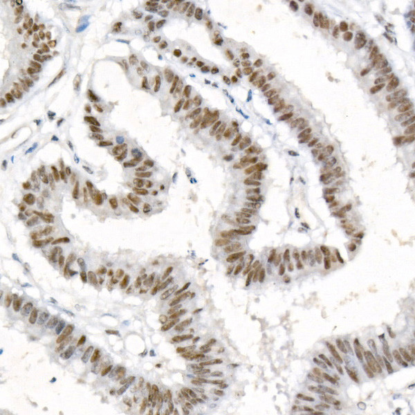 DNA-PK Antibody in Immunohistochemistry (Paraffin) (IHC (P))