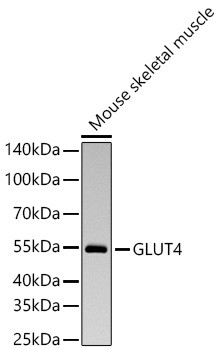 GLUT4 Antibody in Western Blot (WB)
