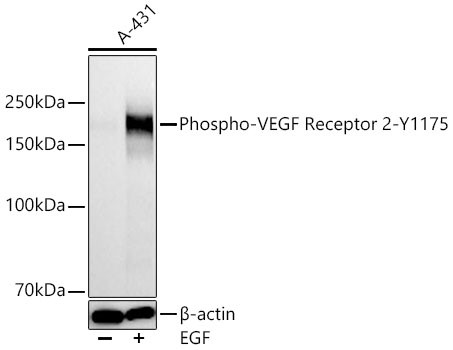 Phospho-VEGF Receptor 2 (Tyr1175) Antibody in Western Blot (WB)