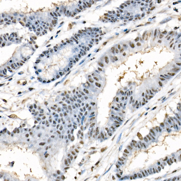 Phospho-Beclin 1 (Ser90) Antibody in Immunohistochemistry (Paraffin) (IHC (P))