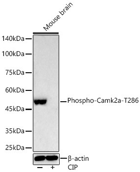 Phospho-CaMKII alpha (Thr286) Antibody in Western Blot (WB)