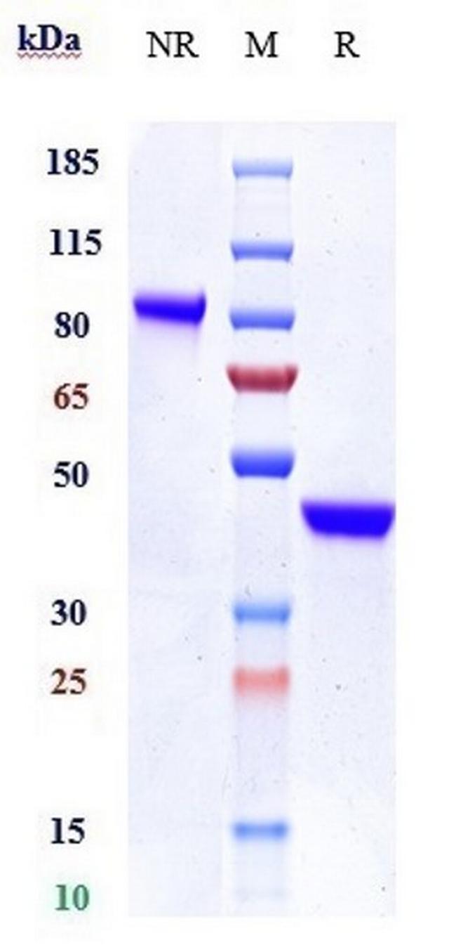 IL-17A Biosimilar Antibody in SDS-PAGE (SDS-PAGE)