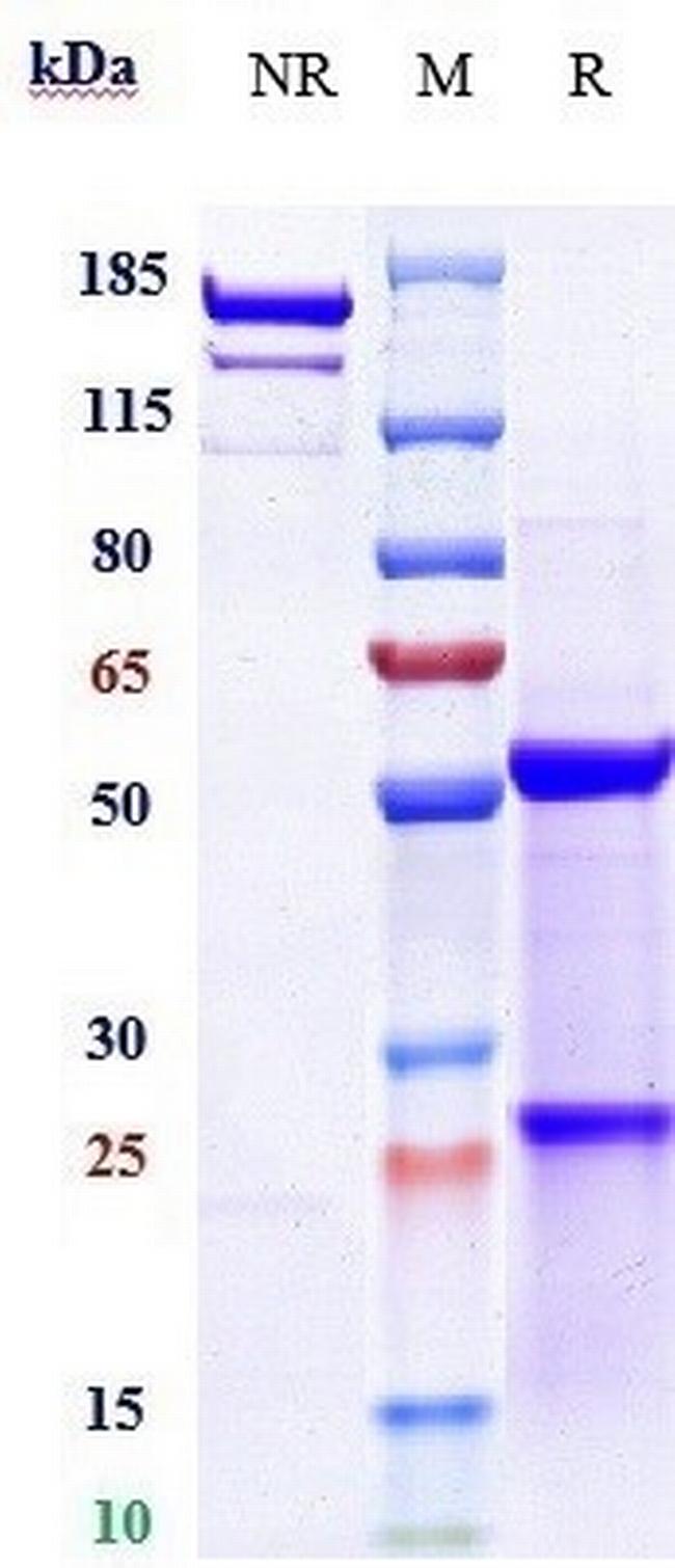 Cixutumumab Antibody in SDS-PAGE (SDS-PAGE)