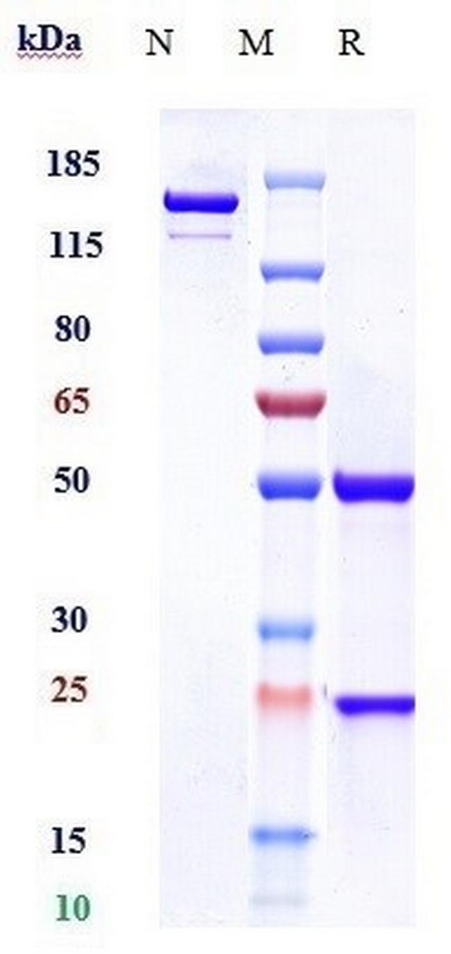 CD5 (Biosimilar) Antibody in SDS-PAGE (SDS-PAGE)