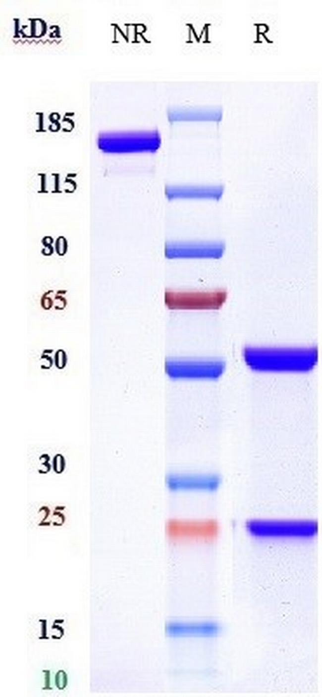 Quetmolimab Humanized Antibody in SDS-PAGE (SDS-PAGE)