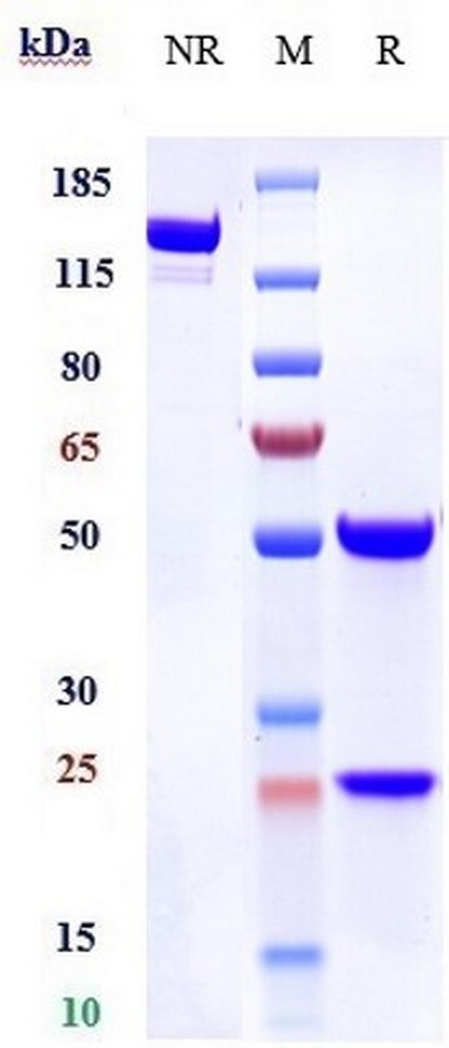 EphA2 Biosimilar Antibody in SDS-PAGE (SDS-PAGE)
