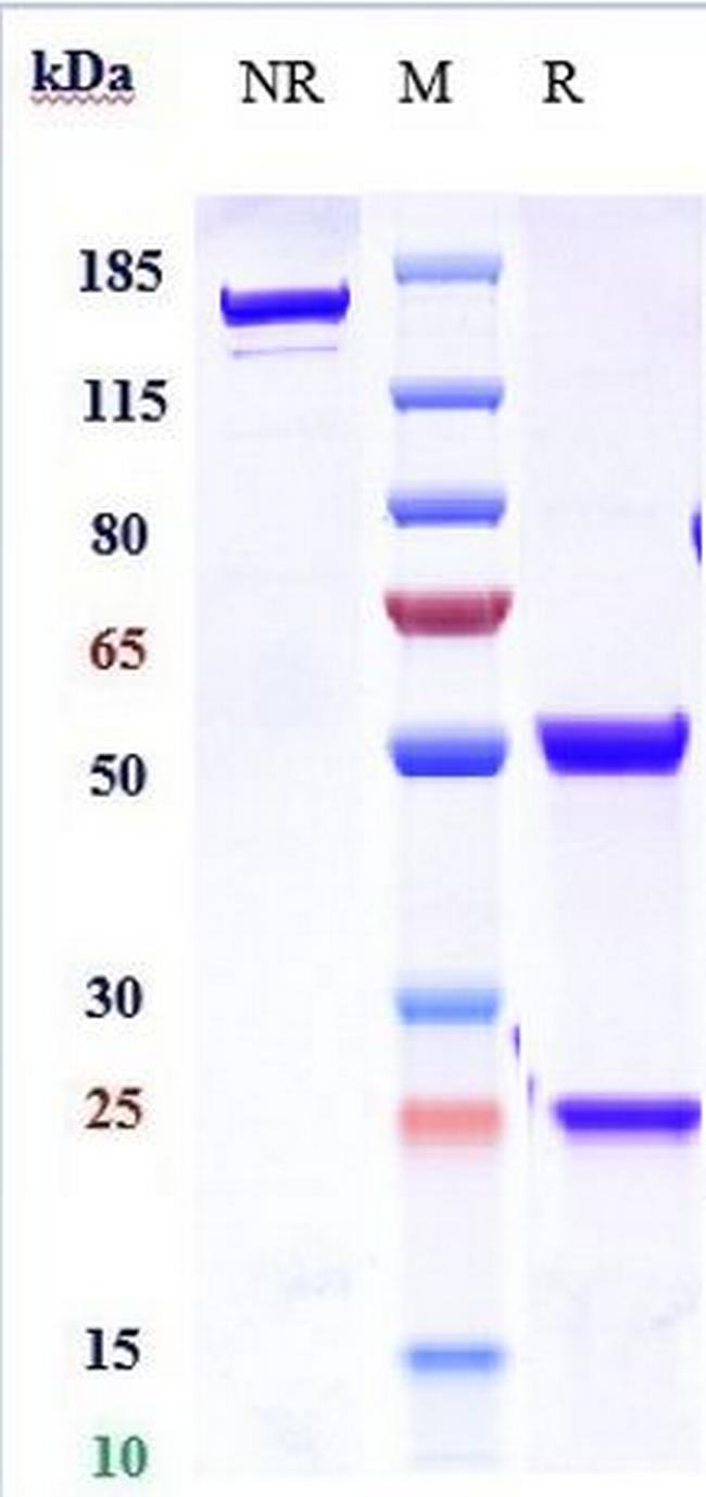 IL-21 Biosimilar Antibody in SDS-PAGE (SDS-PAGE)