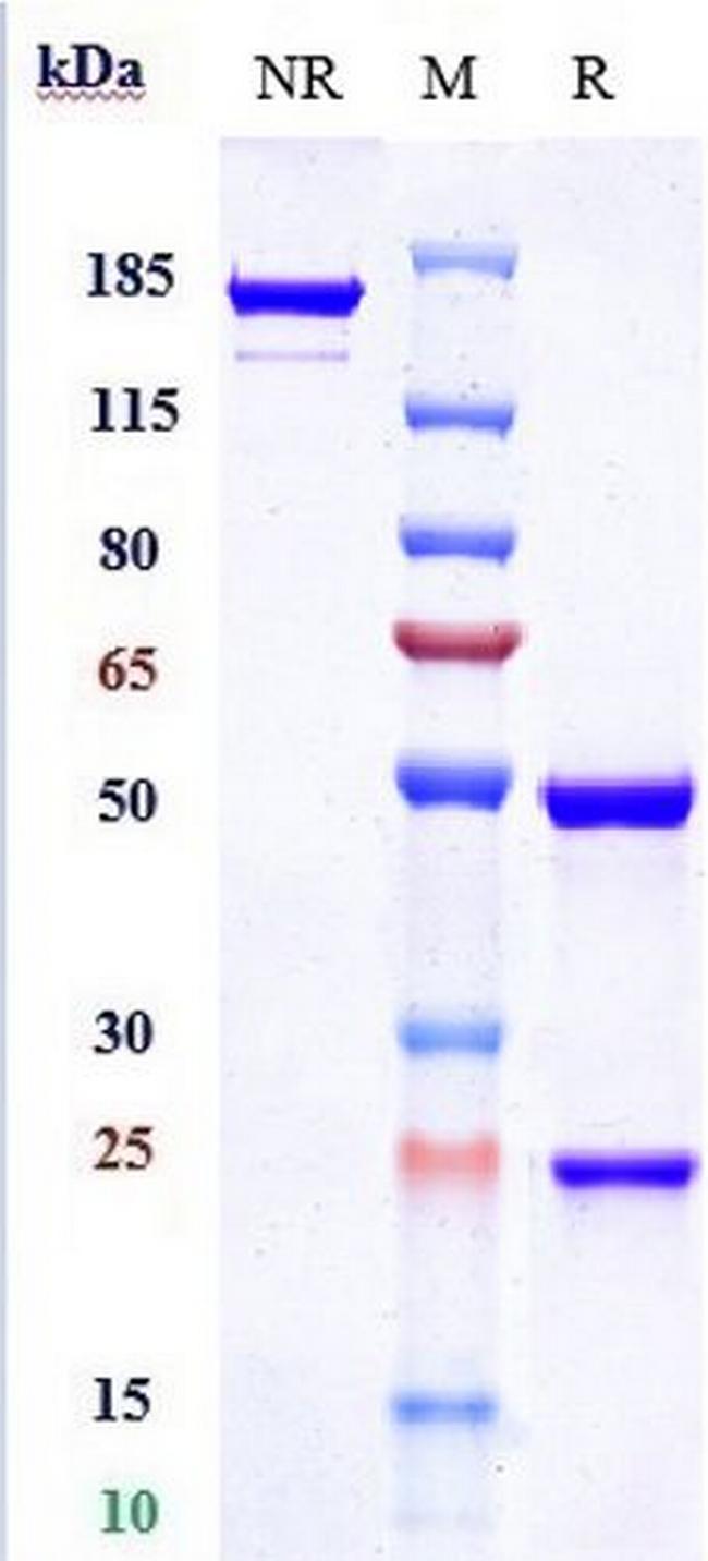 Clazakizumab Humanized Antibody in SDS-PAGE (SDS-PAGE)