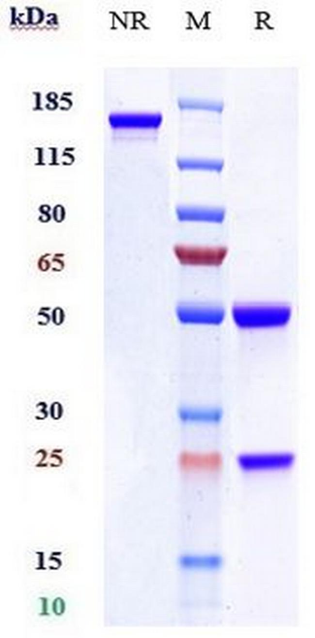 ACVR1 (Biosimilar) Antibody in SDS-PAGE (SDS-PAGE)