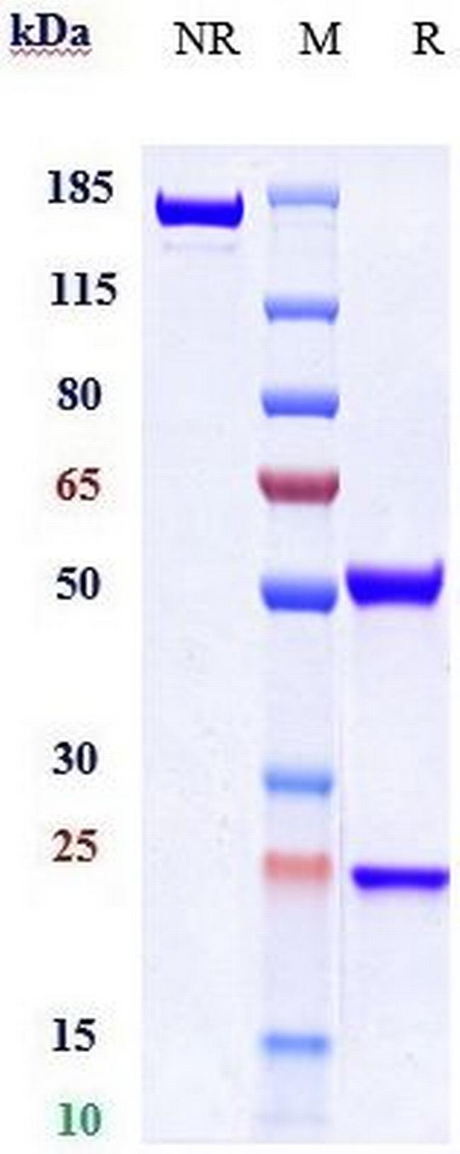 ACVR2A Biosimilar Antibody in SDS-PAGE (SDS-PAGE)