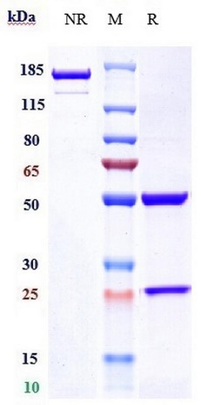 Prasinezumab Humanized Antibody in SDS-PAGE (SDS-PAGE)