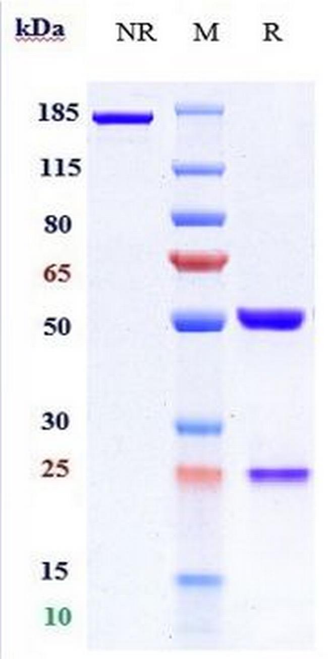 ANGPTL3 (Evinacumab Biosimilar) Antibody in SDS-PAGE (SDS-PAGE)