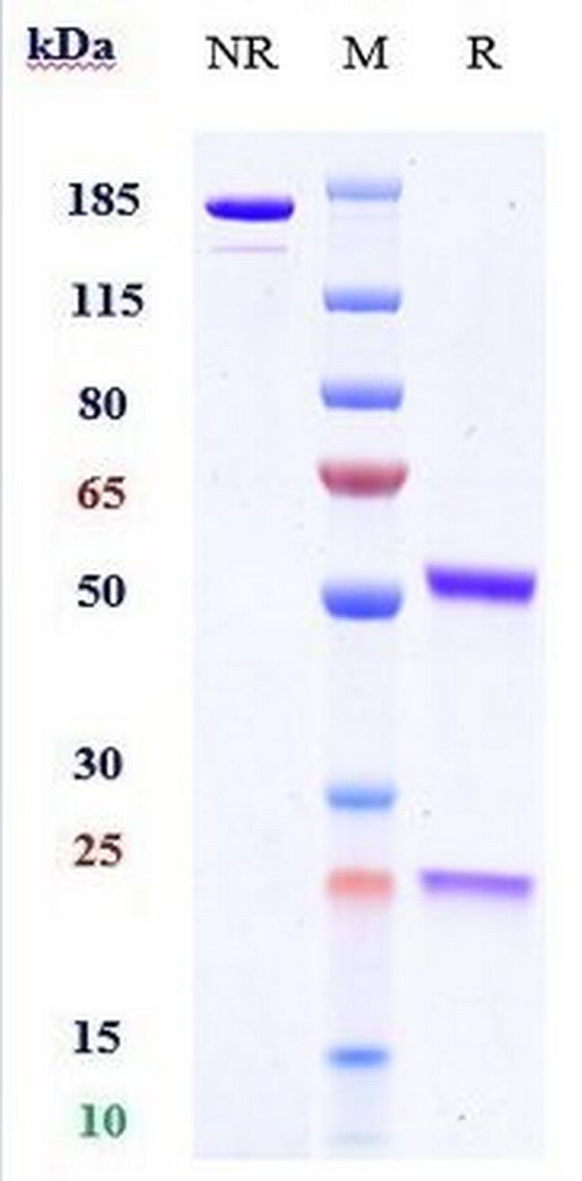 Serum Amyloid P (Dezamizumab Biosimilar) Antibody in SDS-PAGE (SDS-PAGE)