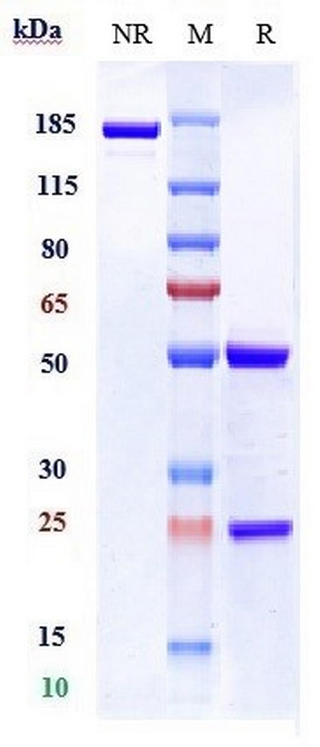 C5AR1 Biosimilar Antibody in SDS-PAGE (SDS-PAGE)