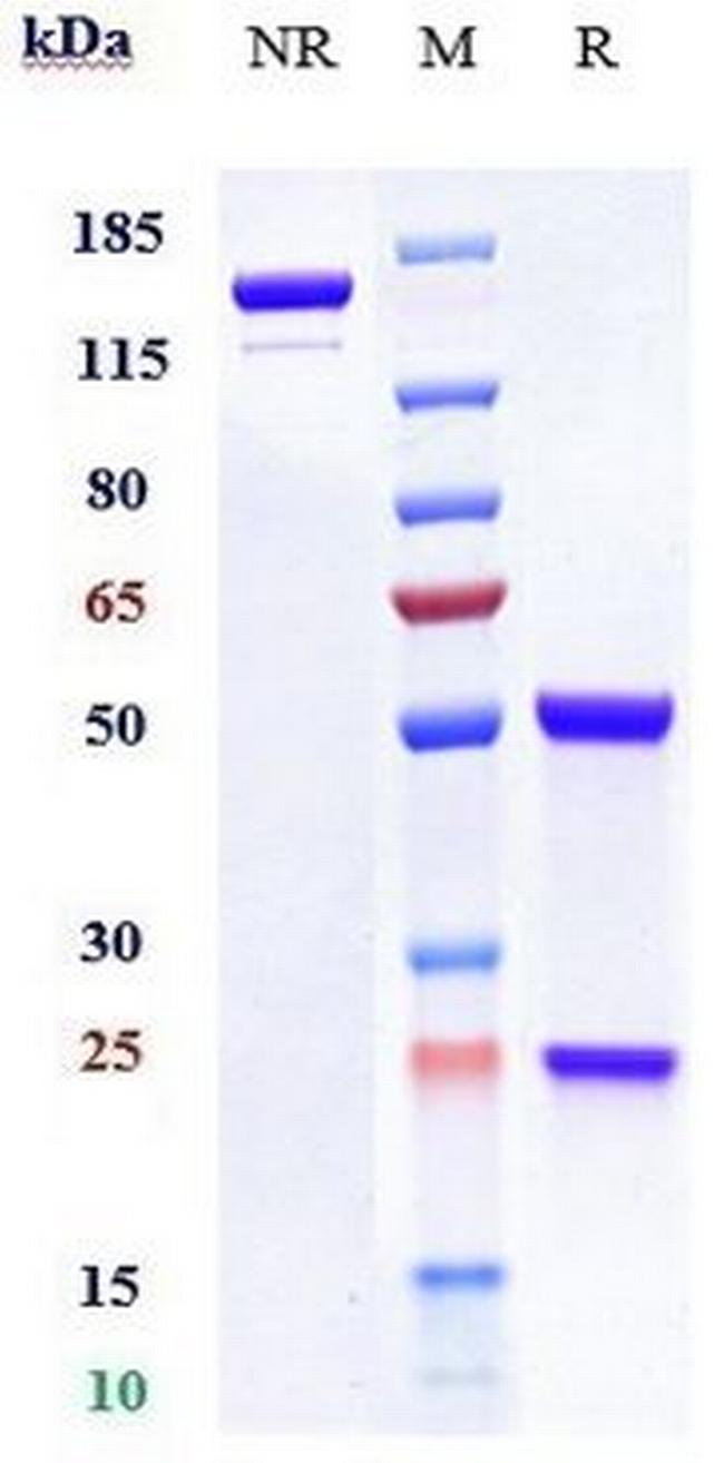 Girentuximab Chimeric Antibody in SDS-PAGE (SDS-PAGE)