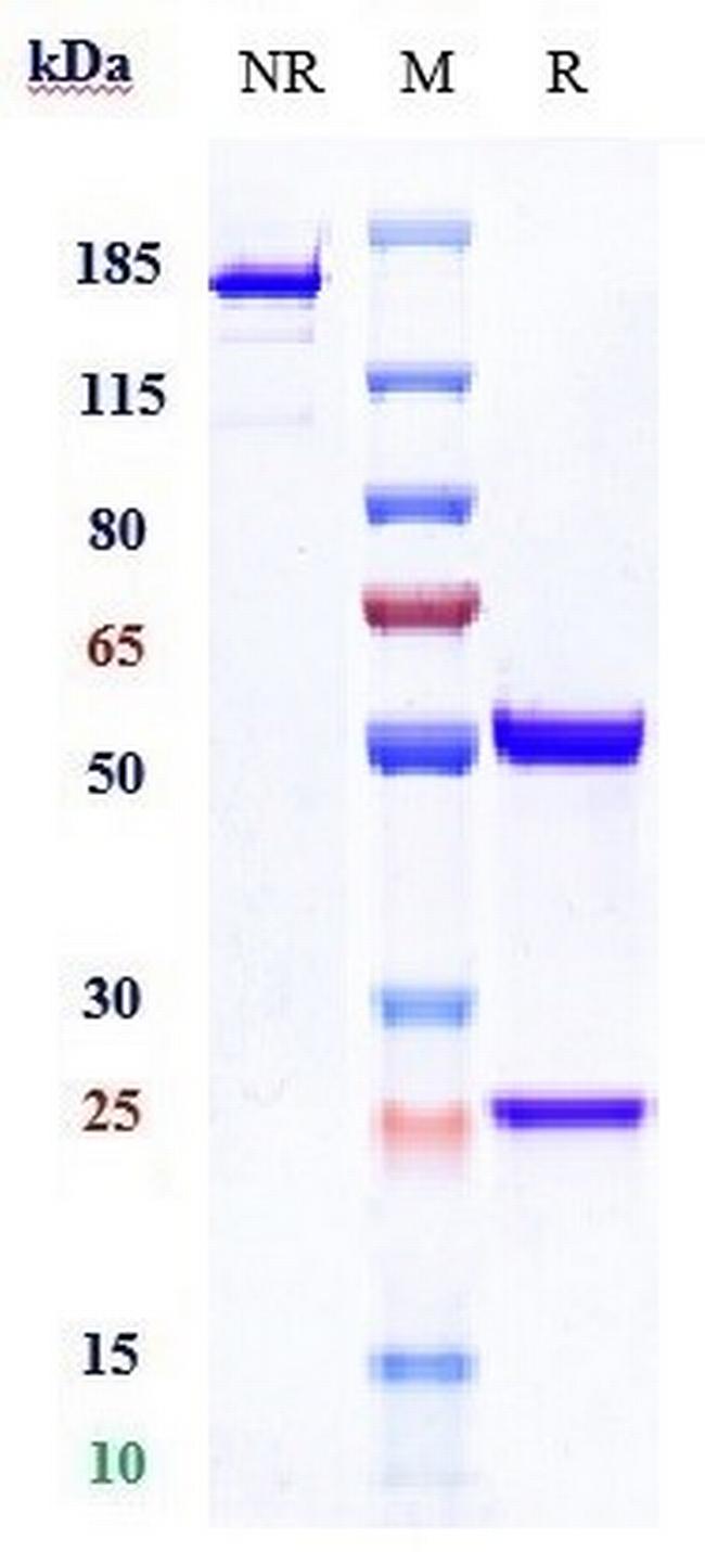 Cathepsin S Biosimilar Antibody in SDS-PAGE (SDS-PAGE)