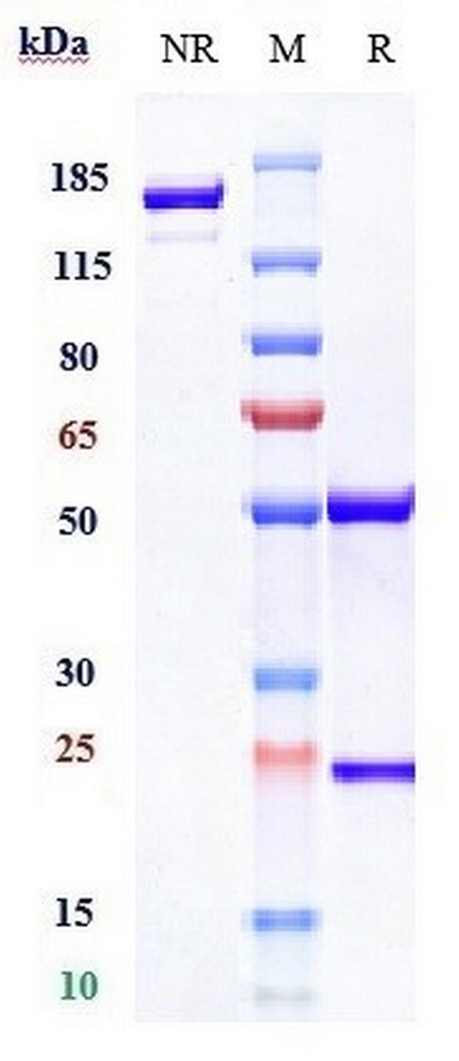 CCL5 (RANTES) Biosimilar Antibody in SDS-PAGE (SDS-PAGE)