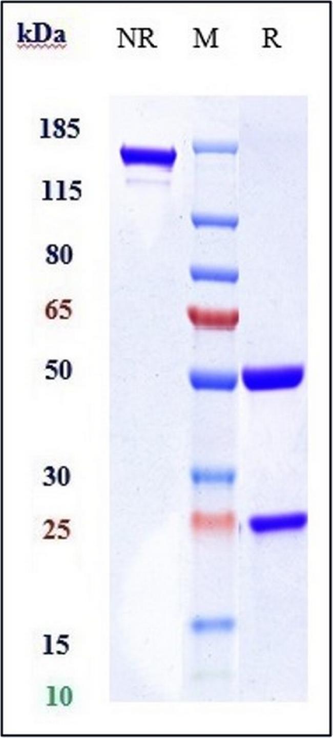 CCR4 (Mogamulizumab Biosimilar) Antibody in SDS-PAGE (SDS-PAGE)