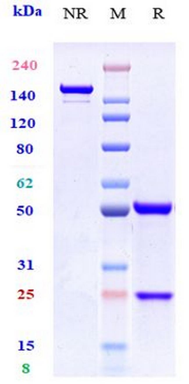 CCR7 Biosimilar Antibody in SDS-PAGE (SDS-PAGE)