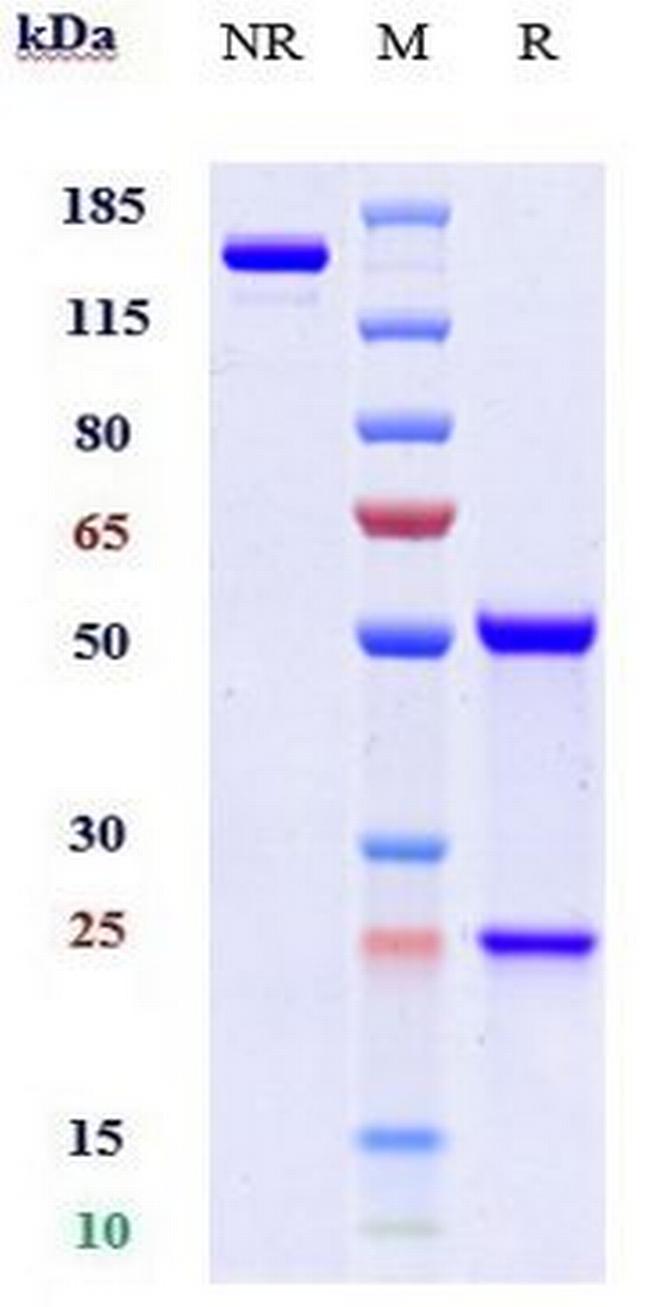 CD200 (Samalizumab Biosimilar) Antibody in SDS-PAGE (SDS-PAGE)