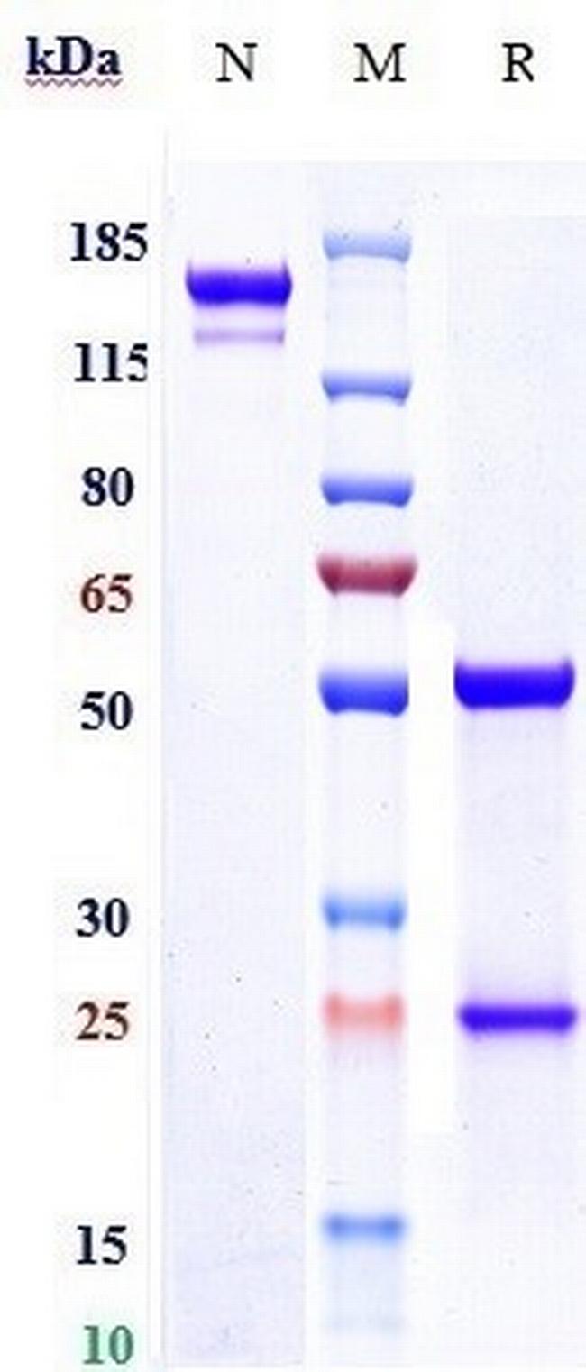 CD39 Biosimilar Antibody in SDS-PAGE (SDS-PAGE)