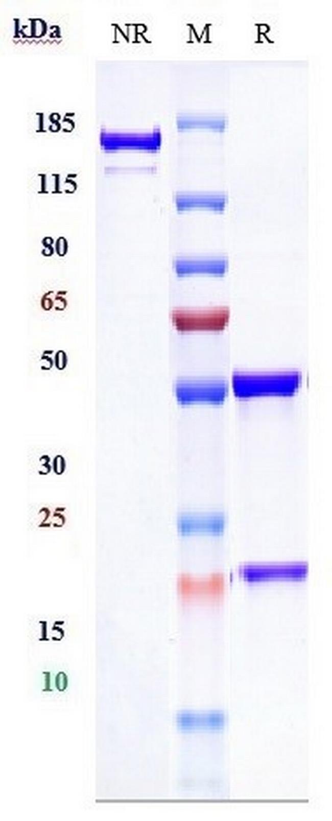 DCBLD2 Humanized Biosimilar Antibody in SDS-PAGE (SDS-PAGE)