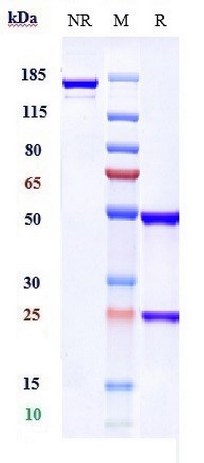 CXCL9 (MIG) Biosimilar Antibody in SDS-PAGE (SDS-PAGE)