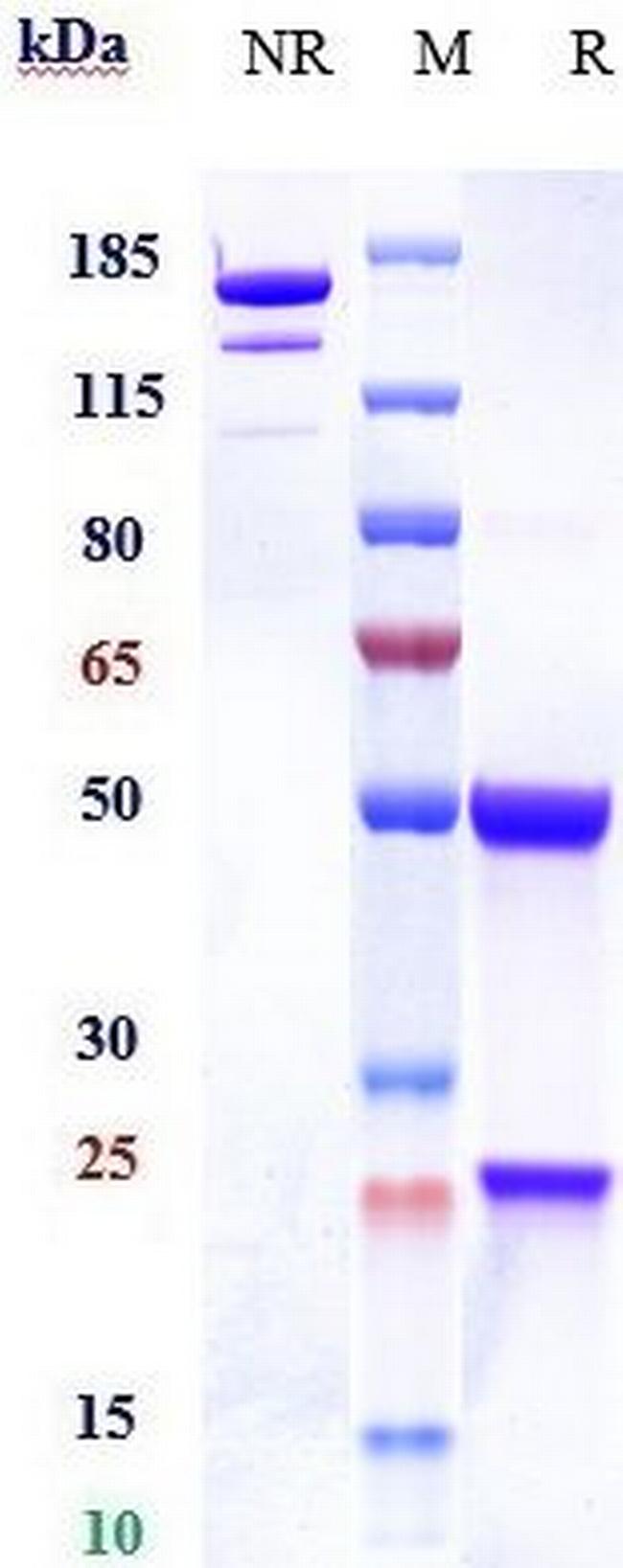 Dectin 1 (Clec7a) Biosimilar Antibody in SDS-PAGE (SDS-PAGE)