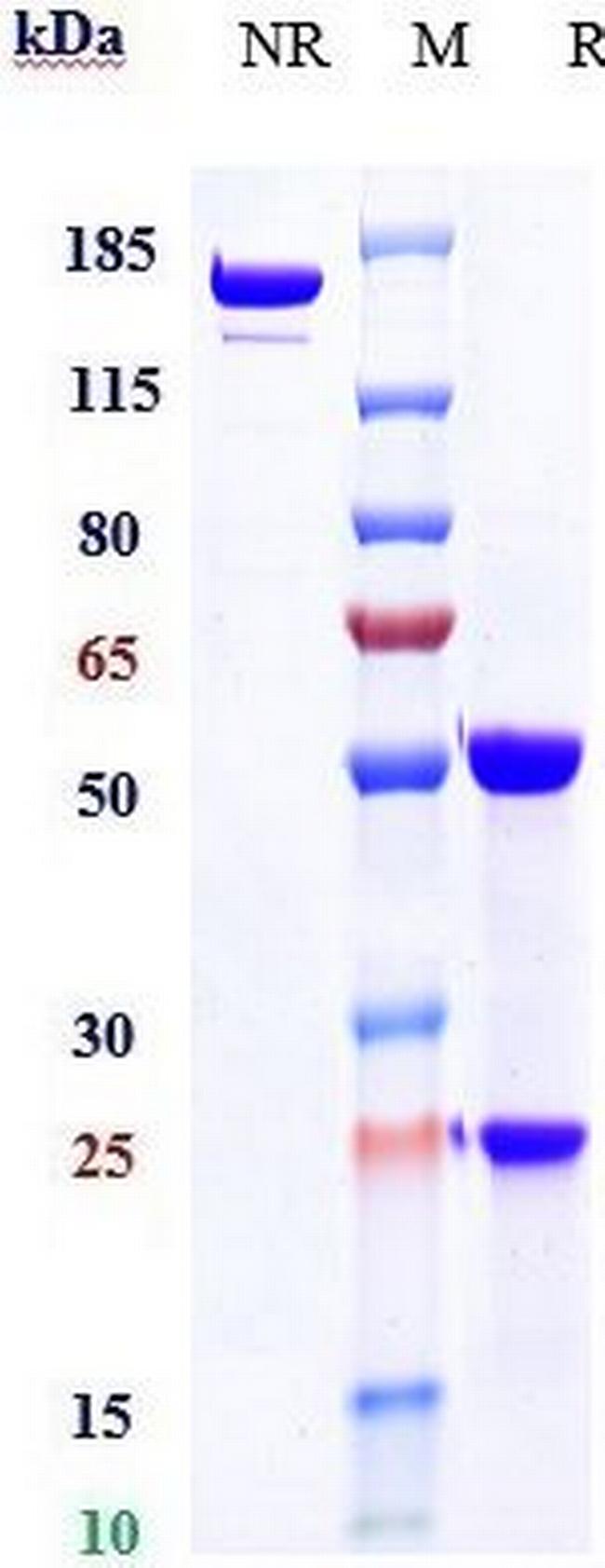 EphB4 (Biosimilar) Antibody in SDS-PAGE (SDS-PAGE)