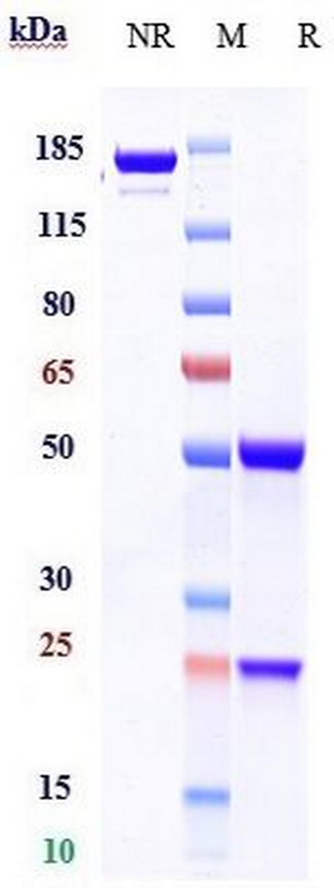 EpoR Biosimilar Antibody in SDS-PAGE (SDS-PAGE)