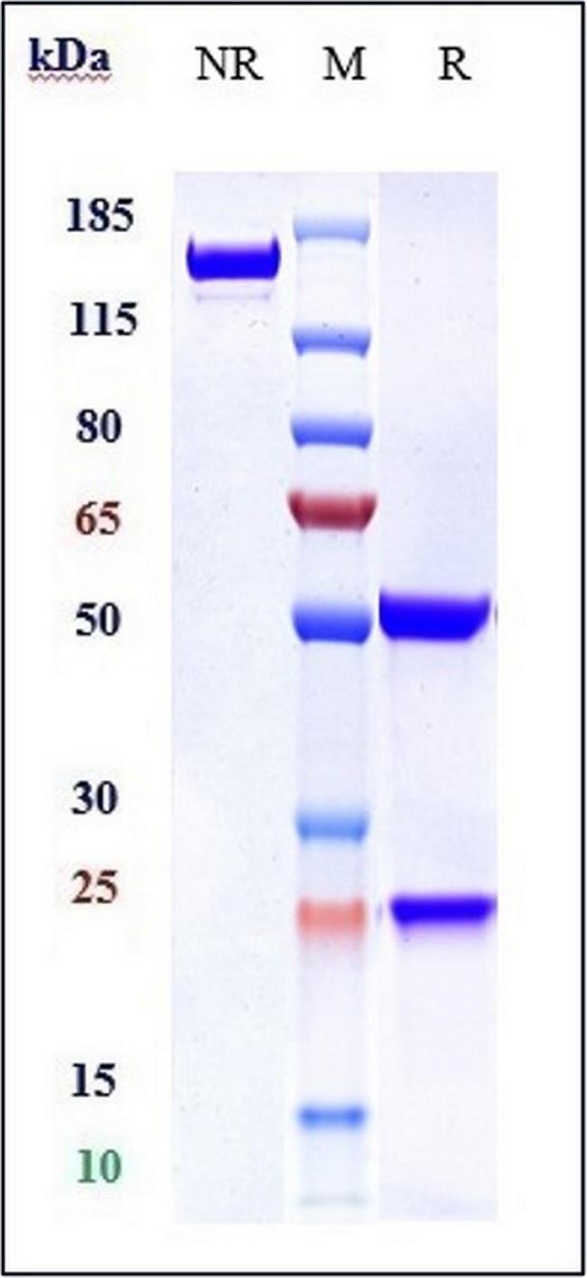 Ferroportin Biosimilar Antibody in SDS-PAGE (SDS-PAGE)