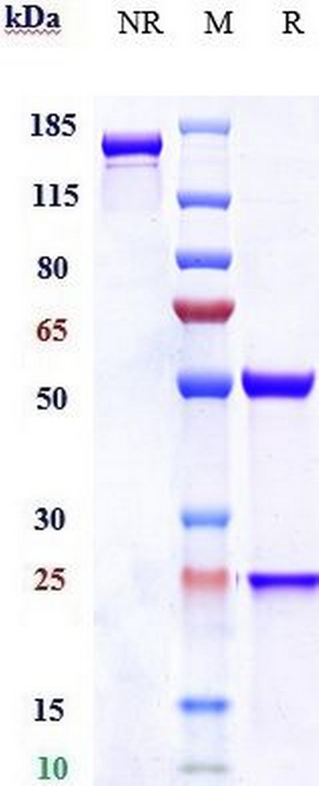 Ferroportin Biosimilar Antibody in SDS-PAGE (SDS-PAGE)