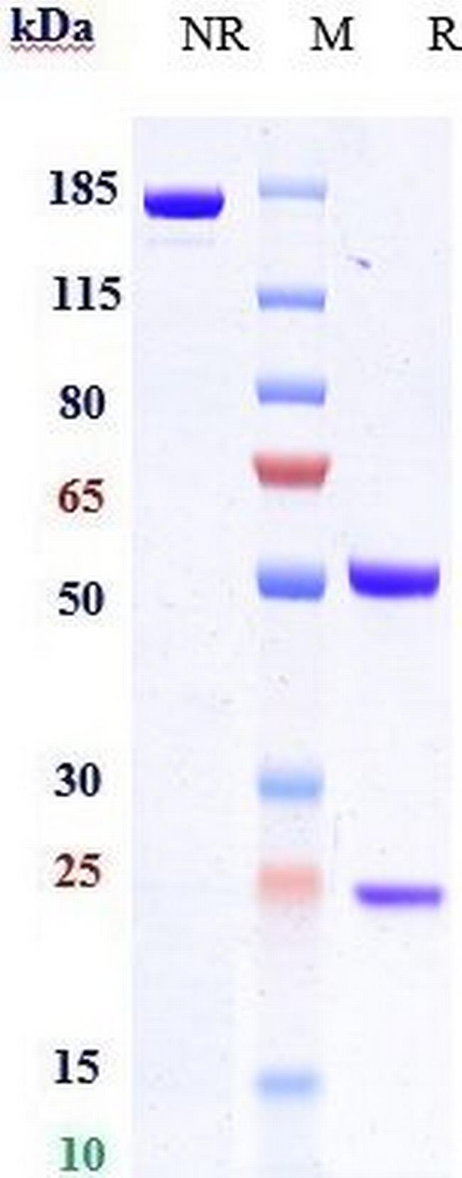 FZD7 Biosimilar Antibody in SDS-PAGE (SDS-PAGE)