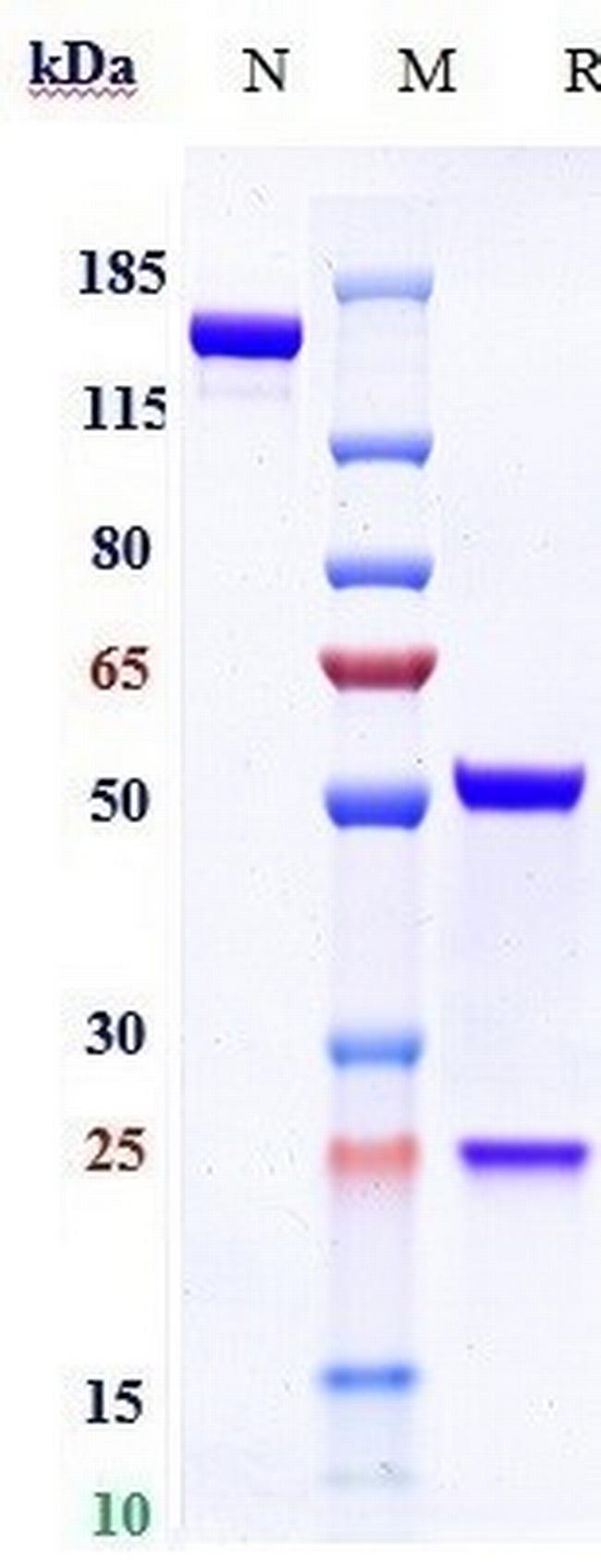 Volagidemab Antibody in SDS-PAGE (SDS-PAGE)