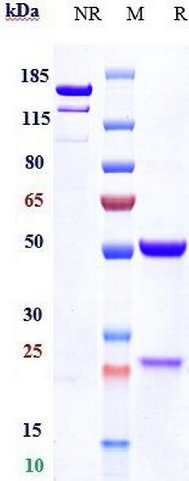 Haptoglobin Biosimilar Antibody in SDS-PAGE (SDS-PAGE)