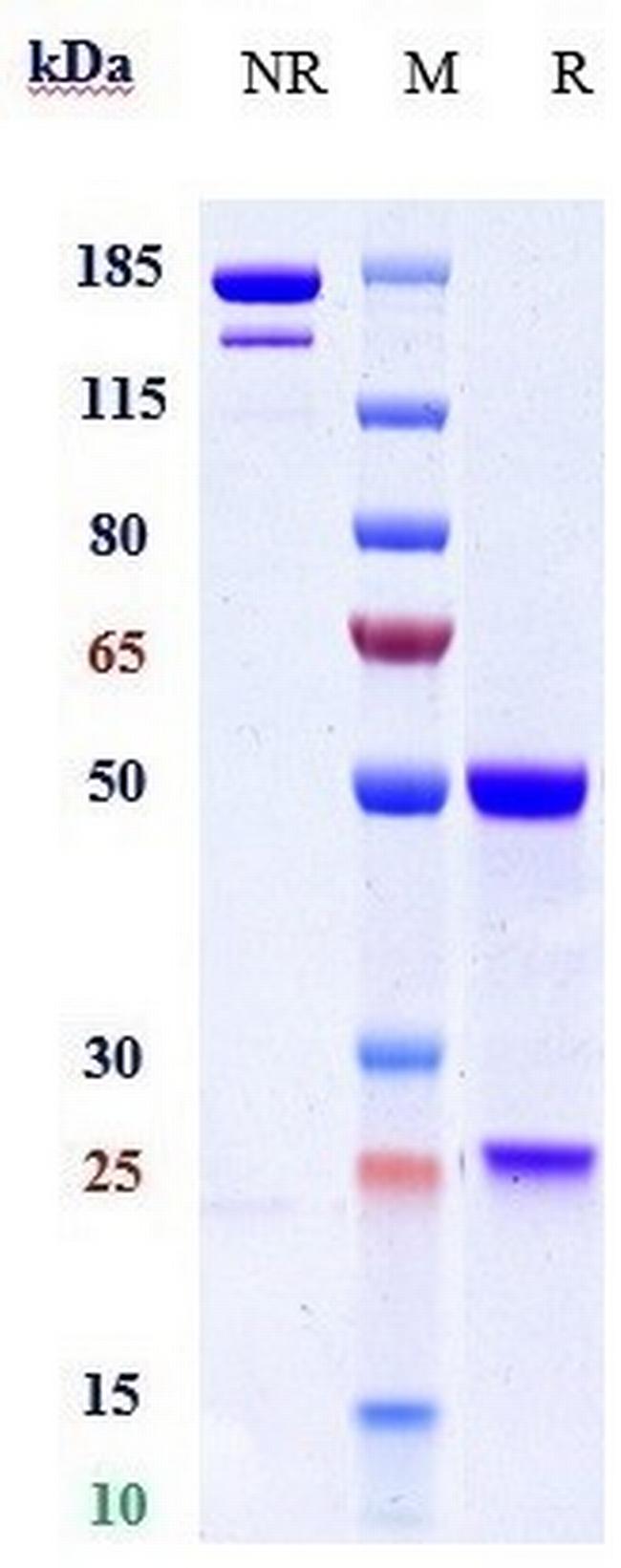 HBEGF Biosimilar Antibody in SDS-PAGE (SDS-PAGE)