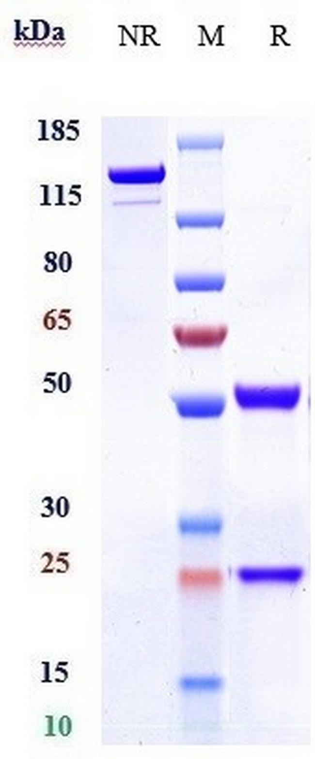 Anrukinzumab Humanized Antibody in SDS-PAGE (SDS-PAGE)