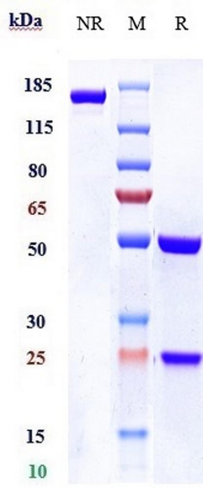 IL1R1 Biosimilar Antibody in SDS-PAGE (SDS-PAGE)