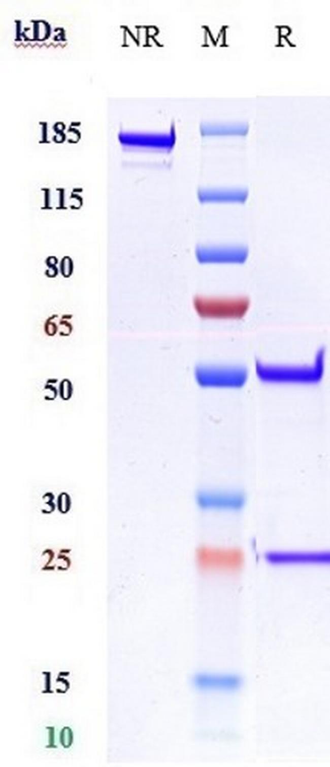 IL1RL2 (Imsidolimab Biosimilar) Antibody in SDS-PAGE (SDS-PAGE)