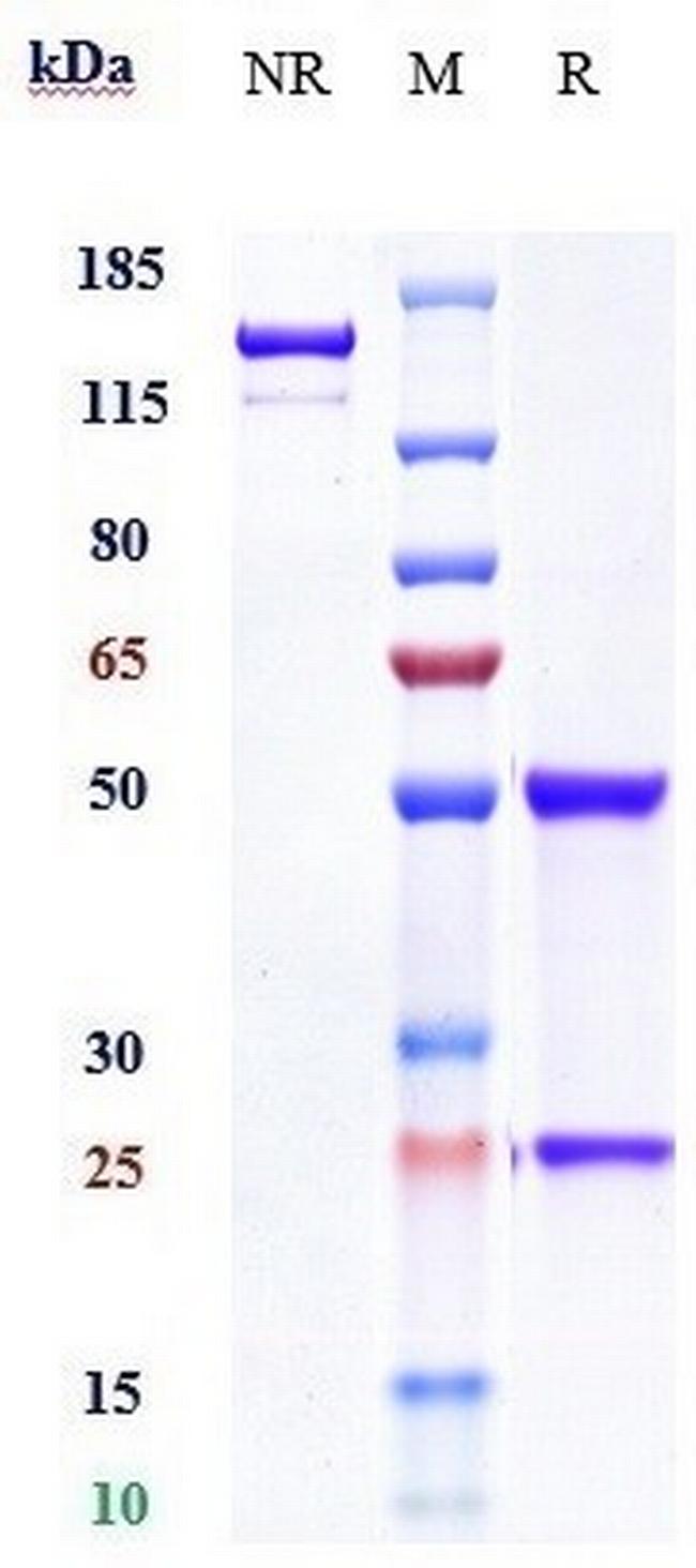 IL20RA Biosimilar Antibody in SDS-PAGE (SDS-PAGE)