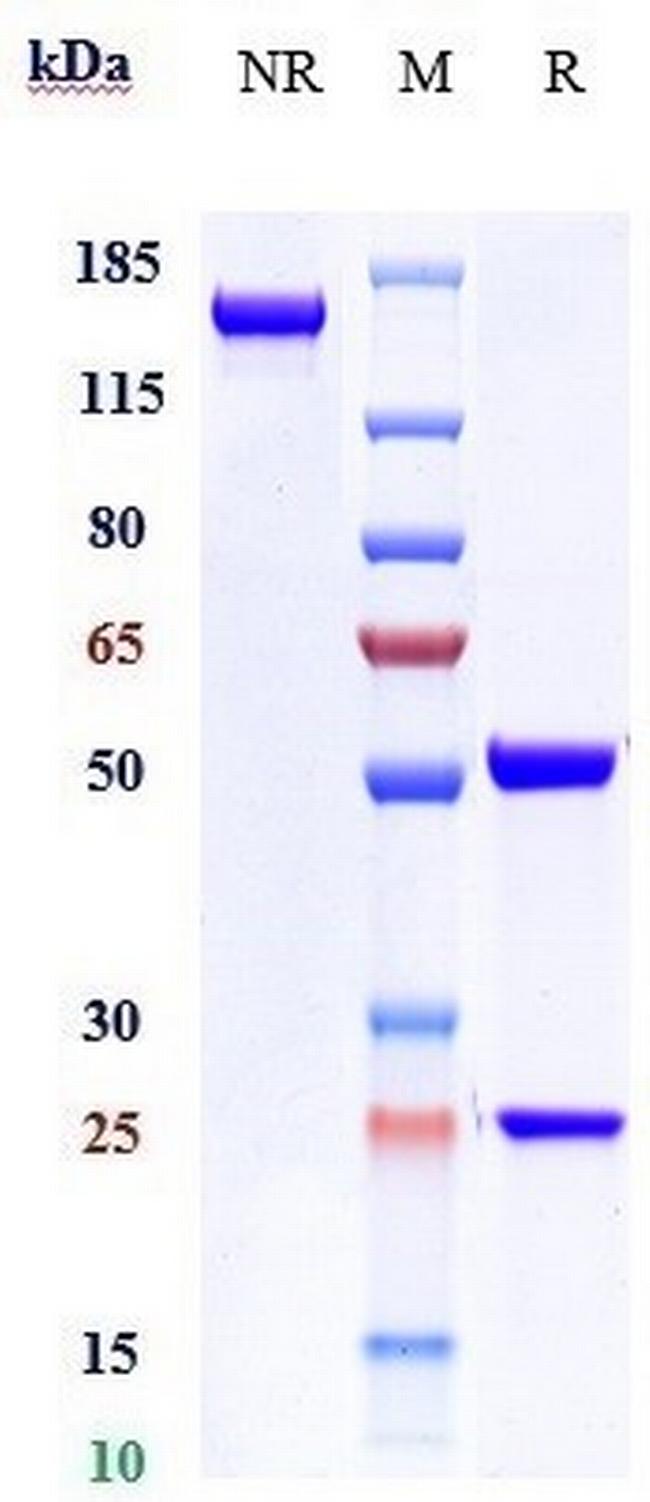 Ontamalimab Antibody in SDS-PAGE (SDS-PAGE)