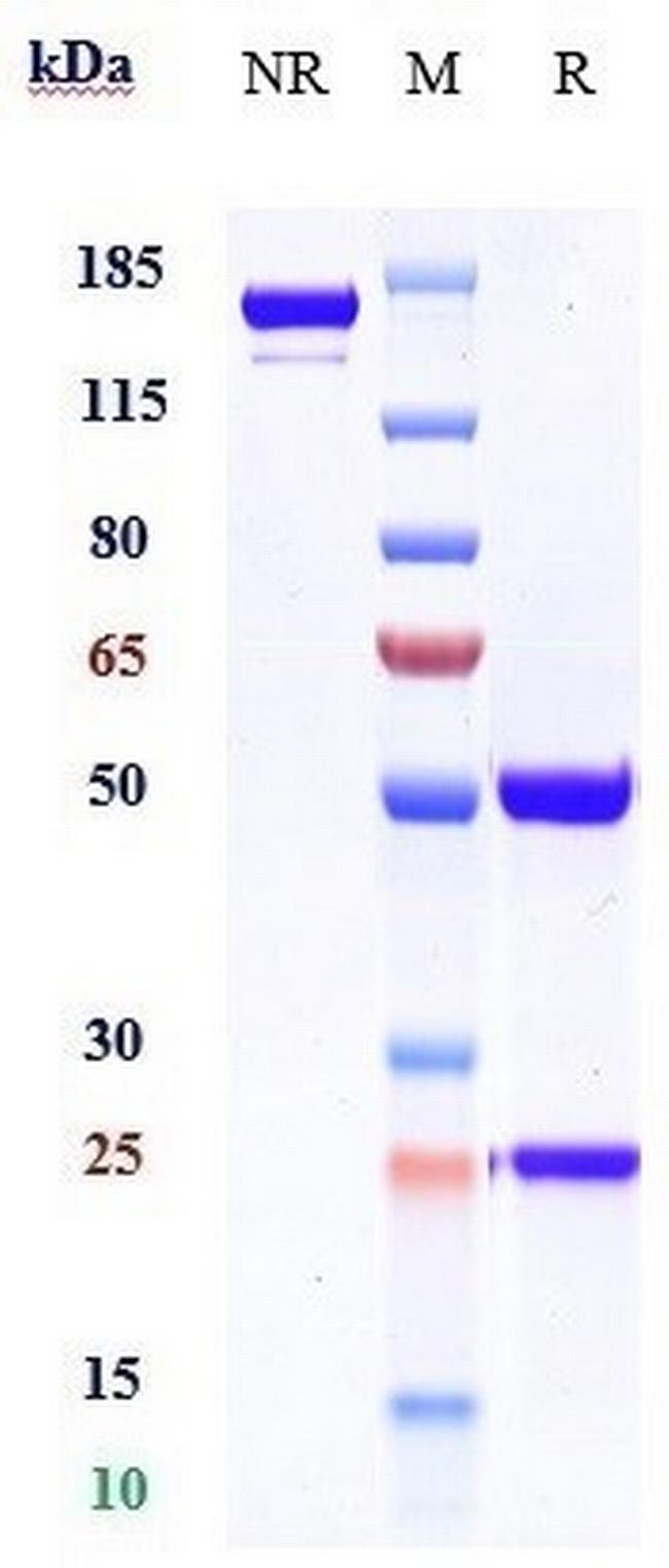 MERTK Biosimilar Antibody in SDS-PAGE (SDS-PAGE)