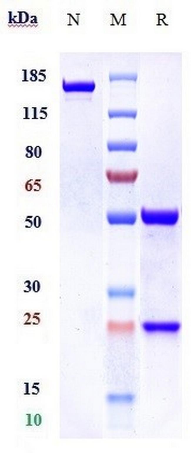 PDGFRB (CD140b) (Rinucumab Biosimilar) Antibody in SDS-PAGE (SDS-PAGE)