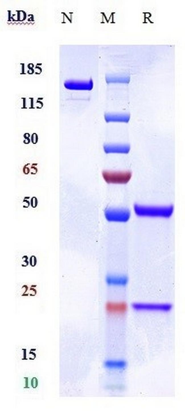 RAGE (Biosimilar) Antibody in SDS-PAGE (SDS-PAGE)